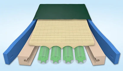 PressureGuard® Custom Care® Reactive Pressure Redistribution Surface